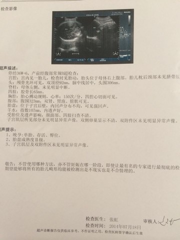 journal_insert_pic_145320708