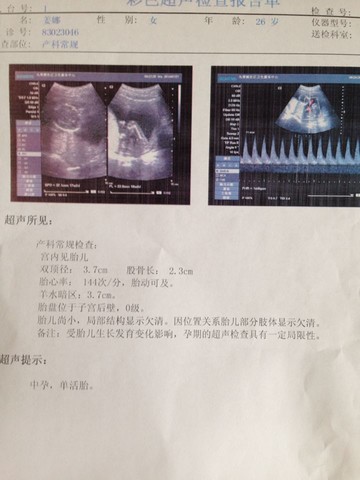journal_insert_pic_145583320