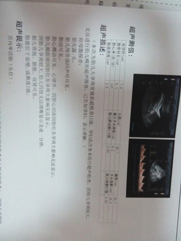 journal_insert_pic_146007809
