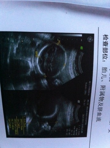 journal_insert_pic_146998940