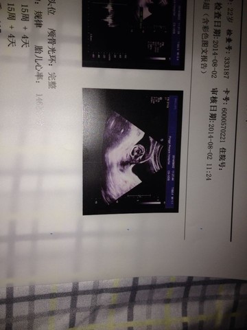 journal_insert_pic_147558976