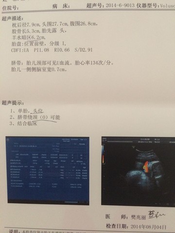 journal_insert_pic_147748154