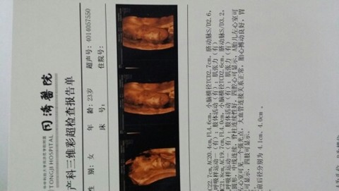 journal_insert_pic_148236193