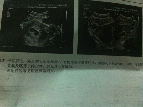 journal_insert_pic_148627538