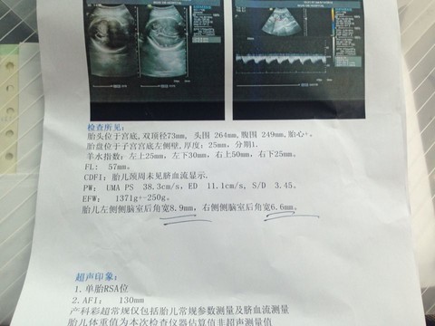 journal_insert_pic_149668055