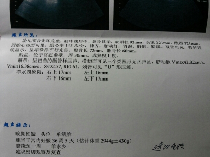 journal_insert_pic_150336078