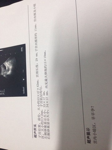 journal_insert_pic_150646233
