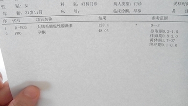 journal_insert_pic_150587982