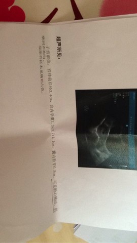 journal_insert_pic_150520364