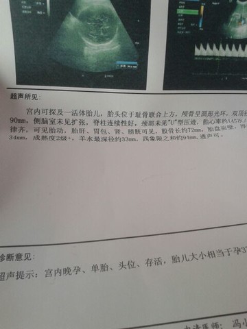 journal_insert_pic_150871930