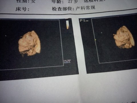 journal_insert_pic_151191911