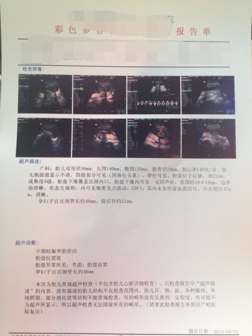 journal_insert_pic_151686706