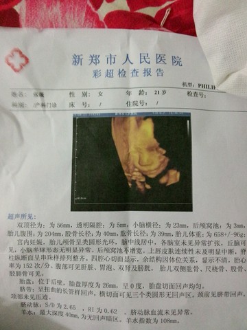 journal_insert_pic_151899812