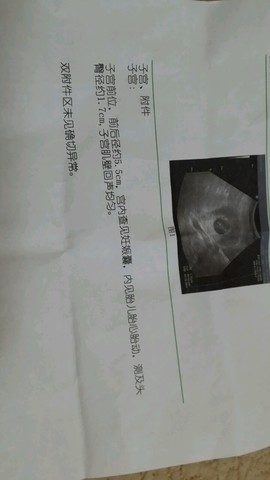 journal_insert_pic_152237545