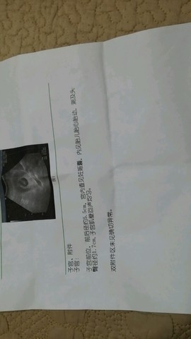 journal_insert_pic_152237530