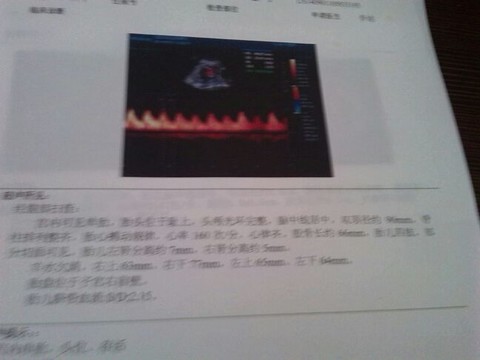journal_insert_pic_152521785