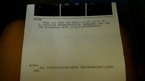 journal_insert_pic_152979531