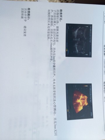 journal_insert_pic_153023126