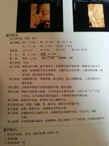 journal_insert_pic_154155622