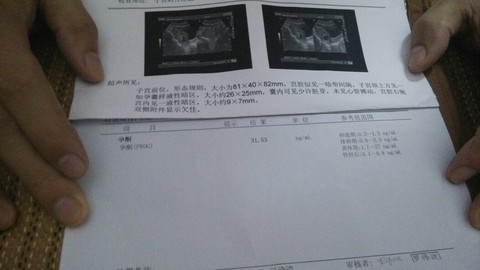 journal_insert_pic_154370803