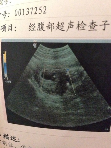 journal_insert_pic_155340170