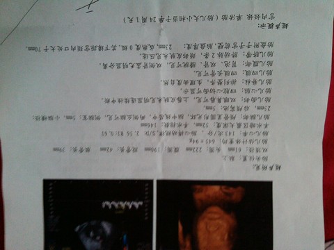 journal_insert_pic_155539129