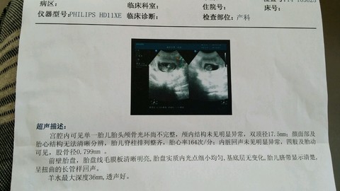 journal_insert_pic_156099550