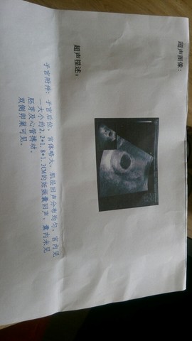 journal_insert_pic_156278886