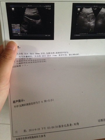 journal_insert_pic_156573943