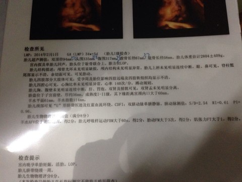journal_insert_pic_157082696