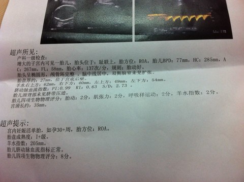 journal_insert_pic_157426755