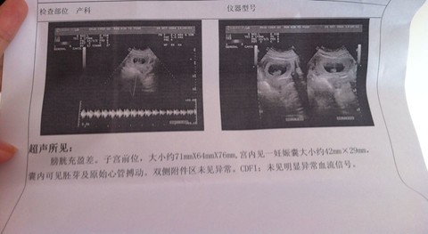 journal_insert_pic_158177403