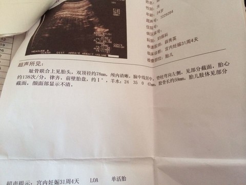 journal_insert_pic_158271804