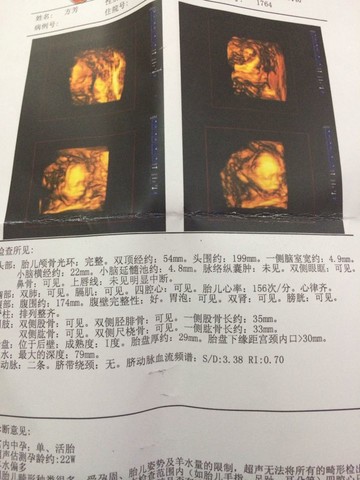 journal_insert_pic_158702102