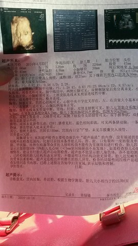 journal_insert_pic_159482819