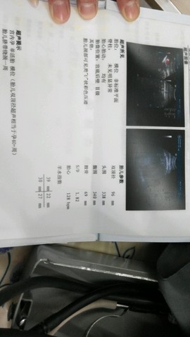 journal_insert_pic_160607991