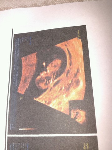 journal_insert_pic_160945052