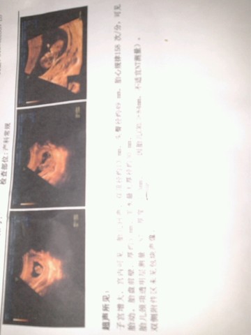 journal_insert_pic_160945100