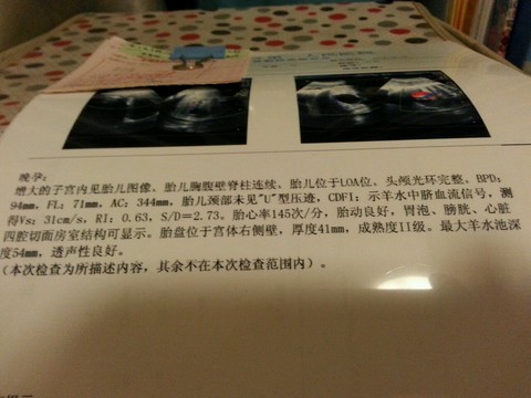 journal_insert_pic_161756913