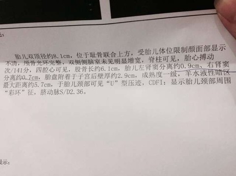 journal_insert_pic_163614666