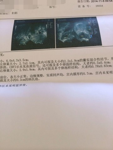 journal_insert_pic_165224042