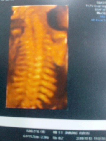 journal_insert_pic_166384288