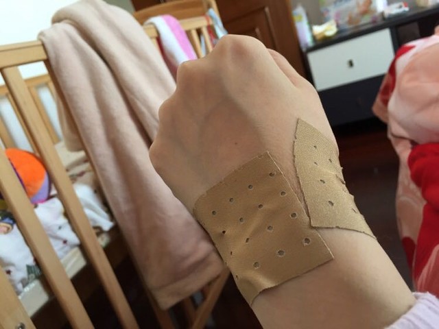 手腕那儿有点疼,不过没你们说得那么严重,就家里找了那种一般的膏药试