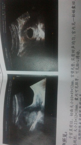 journal_insert_pic_167814398