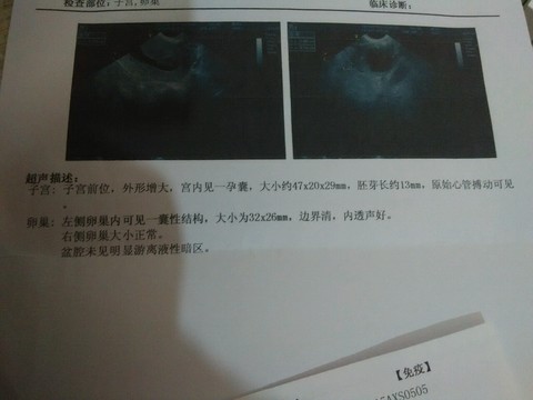 journal_insert_pic_168100202