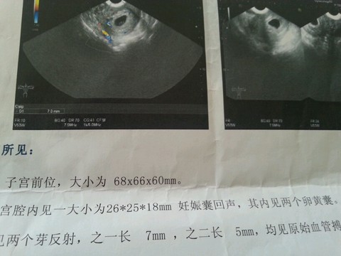 journal_insert_pic_168031999