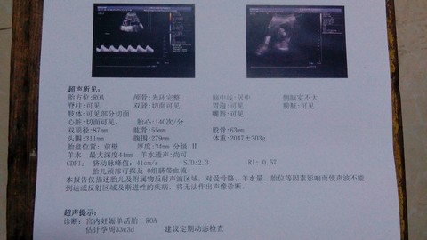 journal_insert_pic_168452970