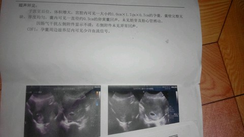 journal_insert_pic_168420013