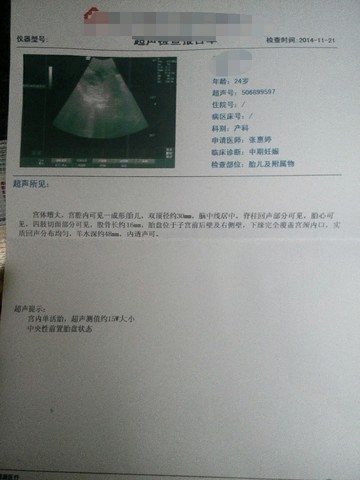 journal_insert_pic_169359156