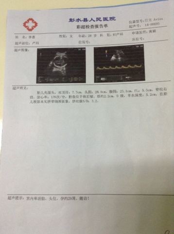 journal_insert_pic_170366660